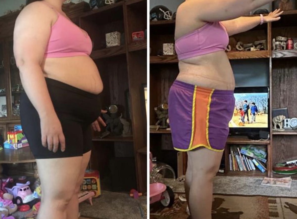 Forever Rising client before and after photo showing side profile fat loss