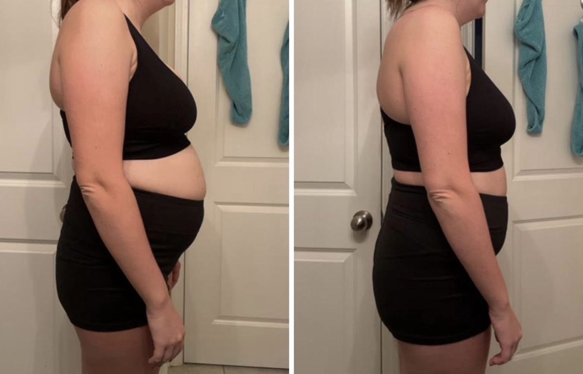 Forever Rising client before and after photo showing a leaner waistline